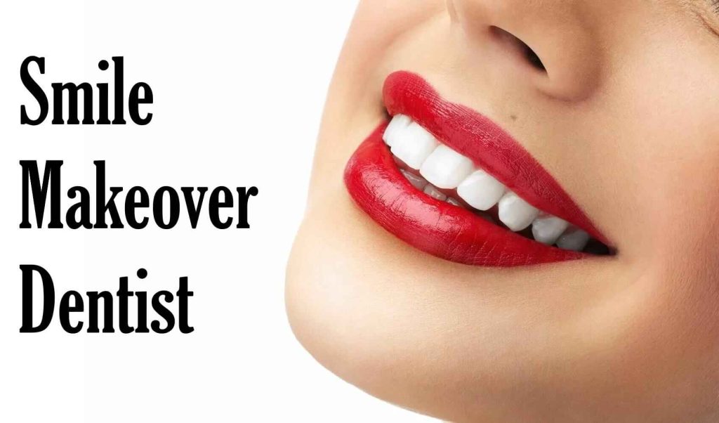 Smile Makeover Dentist